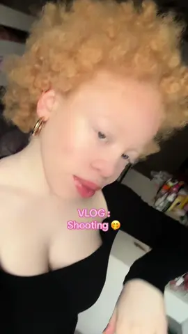 Vous aimez les vlogs ? 🤭 #Vlog #shooting #albinism #photoshoot #photos #albinomodel #pourtoi #fyp #fypシ゚viral #fyp 