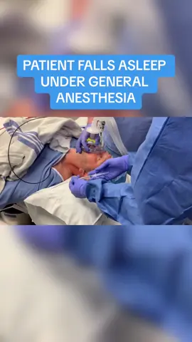 In under 1 minute, witness the captivating journey of general anesthesia. The skilled doctor, also known as an anesthesiologist, administers medications, guiding his patient into a tranquil slumber with remarkable efficiency. Delve into the fascinating world of anesthetic techniques, where science meets serenity. This video is intended for educational purposes only. The techniques demonstrated should only be performed by qualified medical professionals. #health #medicine #doctor #hospital #anesthesia #sleep #surgery #fyp  ⭐️Click the LINK in our BIO to join our new EXCLUSIVE medical community, uniting patients and health professionals!⭐️