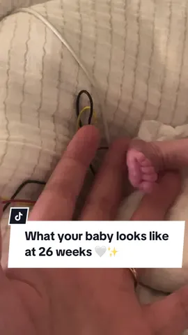 This is what your baby looks like at 26 weeks 🤍 #26weekspregnant #26weeks #prematurebaby #nicujourney #miracle 