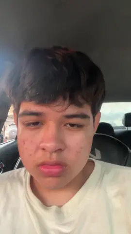 #mewing #fyp #lookmaxing 