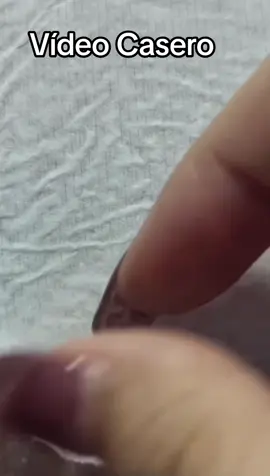 #Extracción #poros #granos#pelo #espinillas #limpiezafacial #acne #tratamientos 