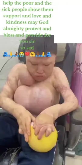 #help #the #poor #care #show #kindness #poorbaby #disability #Love #😭😭😭 #💔💔 #🙏🙏🙏 #🤗🤗 #🥰🥰🥰 