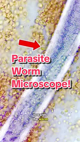 WBCs attack giant parasite worm under the microscope! #worm #parasite #science #stem #microscope #biology #cells #closeup 