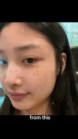 BUY 2 TAKE 1 Freckle removal Cream #fyspotted #fyp #budolfinds #fypシ #antifreckles #freckleremoval 