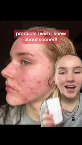 products mentioned: @Dr Sam’s Skincare Flawless Brightly Serum with 10% azelaic acid , code LIFEWITHMILS always gets you 10% off Dr Sam's ad #skincare #skinbarrier #Skintok #skincare #viralskincare #fyp #explore