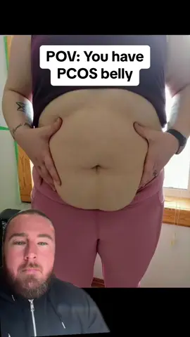 PCOS belly is a symptom of PCOS that so many struggle with that I speak to. PCOS belly is when you store a disproportionate amount of weight around your belly / tummy area. This is SUPER common when you have PCOS due to the unique hormonal imbalances of PCOS, most notably high insulin, androgens & cortisol. These hormonal imbalances, due to their impact on things such as mood, sleep, appetite, metabolism, energy can also make trying to lose this belly fat far more challenging than anybody wants! Let me know in the comments if you can relate to any of this ⬆️⬆️⬆️ Here are some specific tips that may help you: 1) Focus mainly on having a holistic PCOS plan to help improve your overall hormonal health & all aspects of your PCOS. 2) Please, don’t diet! instead follow an eating plan that you enjoy, is well balanced & maximizes nutrient-dense foods over calorie-dense foods. 3) Weights & walking are the MOST effective forms of exercise but honestly, do anything you enjoy 4) 2 cups of green tea daily 5) Try berberine and/or L-carnitine If you’ve found something that has worked for you, please share it in the comments as it may really help somebody else ❤️ If you're looking for an incredible range of targeted supplements all backed by research, 1000's of reviews, with worldwide shipping + FREE shipping options. Head to our bio ❤️ #pcos #pcosweightloss #pcosawareness #pcosdiet #pcossupport #pcosjourney 