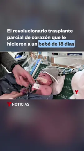 Cuando lo operaron tenía apenas poco más de dos semanas de haber nacido y ahora está a punto de cumplir 2 años de edad.