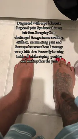 I have good days and I have bad days but both days I Trust That God Will heal me #crpsawareness #crpswarrior #neshiamatthews #flareup #pain #x3  #xybca #christiantiktok #godwillhealyou #trustgod #godsplan 