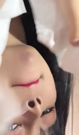 WANNA POP IT? 👉💥👈 #pimplepoppersatisfying 