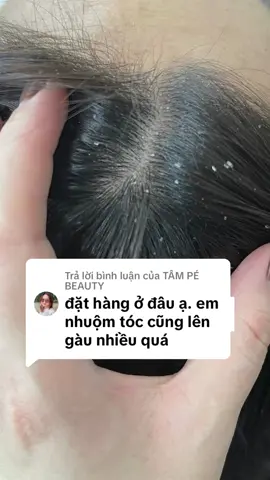 Trả lời @TÂM PÉ BEAUTY gàu nấm thì cứ kết hợp tẩy tế bào chết da đầu và dùng dầu gội giảm gàu santal X nhà c nha em #biocarepharma 