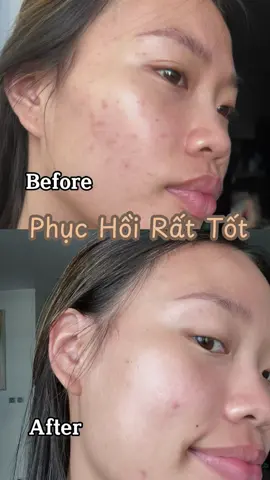 Sản phẩm phục hồi tốt nhất mà Lucia từng dùng 🥇 #fyp #reviewmypham #chamsocda#chamshoi #serumphuchoi #hyaestic  serum B5 Hyaestic #b5hyaestic #hyaesticvietnam 