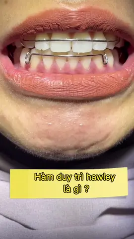 Hàm duy trì hawley là gì ? #nhakhoachinguyenbienhoa #nhakhoachinguyen #CapCut 