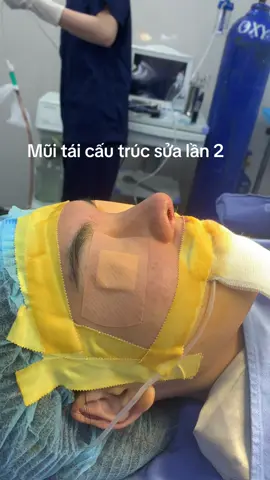 Mũi tái cấu trúc sửa lần 2 #daohoangan 