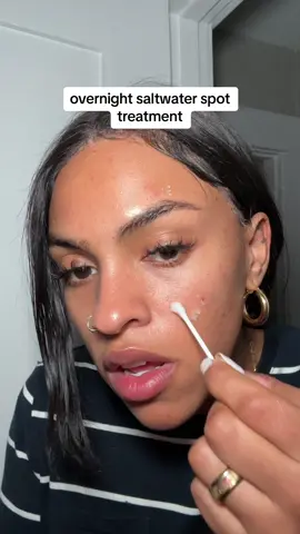 brb omw to get a high frequency wand #spottreatment #overnightacnetreatment #spottreatments #spottreat 