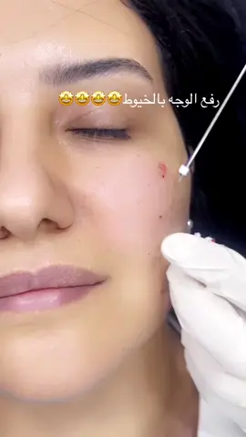 #دكتورة_صباح_الاشموني #ملكة_الخيوط_صباح_الاشموني #مصر_بعيون_خليجية #اكسبلورexplore #جلديةوتجميل ##خيوط_شد_البشرة 