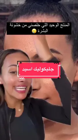 1️⃣  اول شي و اهم شي ان ما نستخدمه علي بشرة مبللة .. لازم بشرتج تكون جافة ✅ 2️⃣  الاستعجال … و الاستخدام الزايد .. ما  نستخدم منه الا قطرتين فقط لا نكثر لانه  راح يسببلك تحسس اذا استخدمتيه غلط ❌  و تبدئين بالتدريج … لاتاخذك الحماسة و تخربين بشترج … و نرطب دايما بعده 🫶🏼 3️⃣ انك تخلطيه مع منتجات ما تتوافق معه 😢 احفظي الريل لان راح تحتاجين تعرفين شنو ما تخلطي معه  ( ساليسيلك اسيد , ريتينول  , لاكتيك اسيد , منداليك اسيد , بنزويل بروكسايد , مقشر الاحماض , اي منتج يقشر البشرة )  في بعض الحالات ننصح بخلطه بس بحالات معينه ✅ 4️⃣ و لا تخرجي بالشمس كثير و لا تنسي واقي الشمس ❤️✅ ما يصير تستخدميه  اثناء الحمل او الرضاعه ❌ يفضل عدم استخدامه ف مناطق تحت العين  و حول الفم لان المناطق  هذي تتحسس بسرعه ♥️  اذا استفدتي من البوست تابعينا 🫶🏼♥️ ننزل كل يوم فيدوهات للعناية بالبشرة رح تخليكي توصلي لبشرة كلها نضاره 💁🏼‍♀️ #جليكوليك_اسيد #مقشر #اورديناري #عناية #بشرة_صحية 