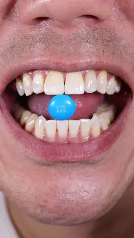 ASMR | 🔵 m&m
