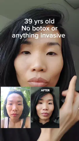 Natural face lifting is easier than you think. Facial exercises also improves its elasticity, stimulates the production of collagen, and makes your skin look younger. Simple exercises make huge differences. It only takes you 2 to 3 minutes a day. Try it today, you will be amazed by the results. #cheeklifting #facelifting #SelfCare #trinhgeorg #antiaging #antiagingtips #naturalbeauty #facelift 