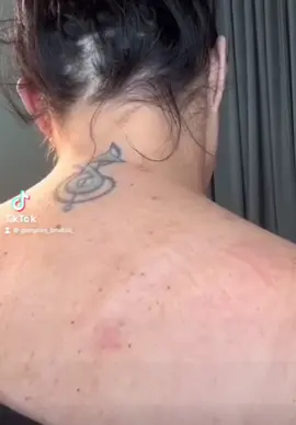 #cravos #brufoli #blackhead #zit #pimples_brufoli_ #popping #asmr #zits #pimples #granos #acne #popper #pimple #pimples_brufoli #pimplepop #granosyespinillas 
