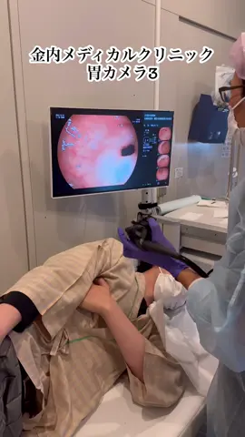金内メディカルクリニック 上部内視鏡検査 #金内メディカルクリニック #人間ドック #心臓ドック #健康診断 #内視鏡 #胃カメラ #上部内視聴検査 