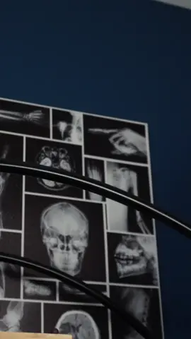 ASMR POV part 26: cranial nerve examination | ear checkup |neurological exam | head and face examination for  | medical roleplay for sleep and relaxation & sharp or dull tests #madpasmr #cranialnerveasmr #asmrheadscratch #cranialnerveexam #asmrface #asmrfacetouching #asmrmedical #asmrmedicalroleplay #asmrmedicalexam #asmrdoctor #asmrdoctorroleplay #asmrrealperson #asmr #asmrsounds #asmrsensory #asmrroleplay #asmrvideo