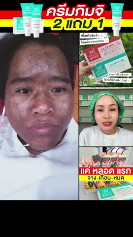 #เทรนด์วันนี้ #ครีมกิมจิ #ครีม #บํารุงผิวหน้า #ออร่า #ติดสาร #ผิวพรรณกระจ่างใส #จุดด่างดํา #รอยดํา #ฝ้า​ #สิว #รอยแดง #กระ #ผิวหน้า #อย่าปิดการมองเห็น 