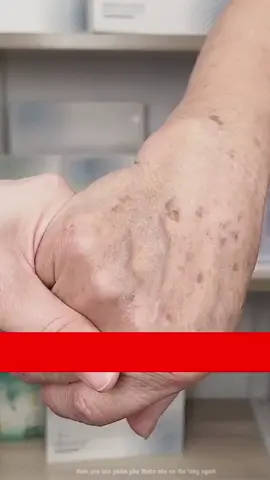 kem bôi Dr.li hỗ trợ giảm nám , tàn nhang , đồi mồi ...11.236 khách hàng đã tin tưởng sử dụng