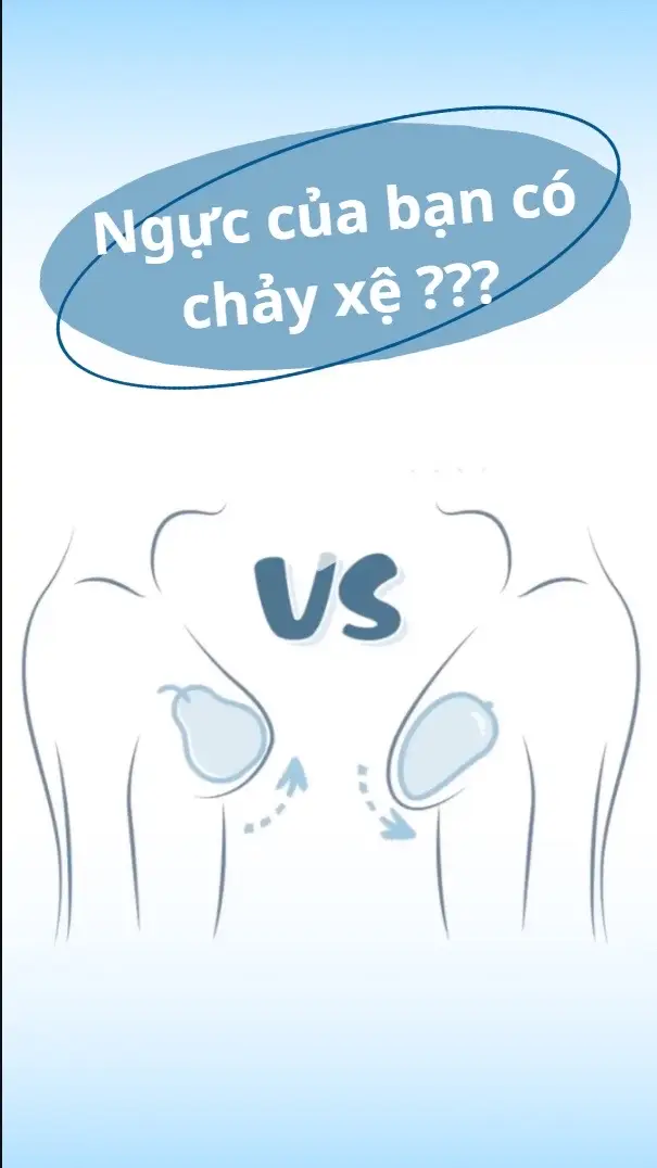 Ng.ực của bạn đang ở mức độ nào 😊#bacsitanhuy #nangv1 #body #xuhuongtiktok #xinhdep #baby 