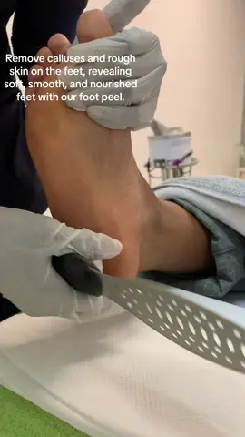 Remove calluses and rough skin on the feet, revealing soft, smooth, and nourished feet with our foot peel. You can get it done while you are doing your facial treatment.  . . . #footpeel 