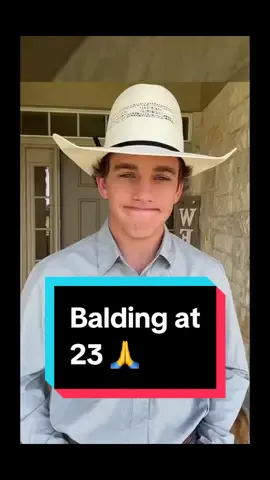 Hair loss is NOT fun but balding young is a real nightmare. If you get on top of hair loss early when youre just noticing thinning, youve got the odds stacked in your favor to keep your hair 💪. #balding #hairloss #motivation 
