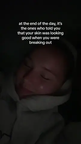 you are a good friend if you do this *acne healing guides in my bio*   #skincare #acne #acnerelatable #skintok #breakout #explore #fyp #skinbarrier 