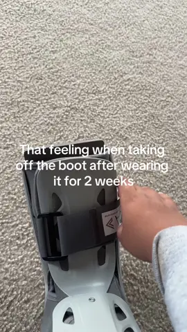 Ik im still limping but it’s healing fine #fyp #injuries 