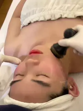 CÔNG NGHỆ RF NÂNG CƠ ✔Nâng cơ công nghệ RF là việc sử dụng thiết bị có sóng điện từ trường tác động trực tiếp lên vùng da đang gặp các vấn đề cần điều trị như thâm nám, nếp nhăn, chảy xệ… ✔Sóng RF là một loại sóng điện từ nằm ở mức thấp nhất của tần số bức xạ điện từ. Khi bước sóng này đi vào sâu dưới da, tác động nhiệt lên các mô ở lớp hạ bì sẽ kích thích tăng sinh collagen và elastin tự nhiên của cơ thể giúp nâng cơ và làm cho da săn chắc hơn.  Đồng thời, chăm sóc da bằng sóng RF còn tăng quá trình trao đổi chất, giúp da hấp thụ tốt các dưỡng chất có lợi. Tăng khả năng tuần hoàn, lưu thông máu, tăng khả năng hấp thụ oxygen của da. 👉🏻 chị em ở Đà Nẵng, Hà Nội, HCM muốn đăng ký công nghệ RF thì ib Hà nhé❤️ #RF #mdd #mddermatics 