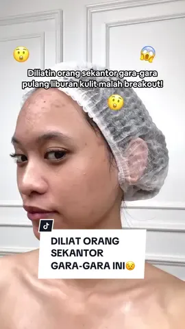 Kena mental dikit nggak ngaruhhh soalnya ada treatment yang bisa bantu atasin masalah breakout di wajah! ✨ BREAKOUT FREE PHYTO FACIAL ✨ Adalah salah satu rangkaian treatment dari paket The Radiance of 3R-1P yang dirancang khusus untuk kamu yang saat ini mengalami masalah kulit breakout, bruntusan, dan bekas jerawat hitam Cuma dengan 200 ribuan Ella Friends bisa mencoba treatment ini di Ella Skin Clinic terdekat loh! Yuk booking sekarang dan rasakan sendiri hasilnya di kulit wajah kamu 😉💕 #JuaranyaAtasiMasalahKulit #ellaskincare #ellaskincareofficial #ellaskinclinicofficial #ellaskinclinic #fyp #foryou #foryoupage #TulusTerpercaya #treatmenttime #metime #rekomendasitreatment 