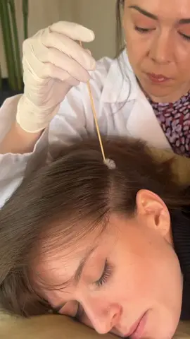 ASMR sharp or dull - soothing scalp exam #asmr #asmrsounds #asmrsound #asmrsoundsdaily #asmrsoundsgirl #asmrsoundsontiktok #asmrvideo #asmrvideos #asmrvideosounds #asmrtiktoks #asmrtiktok #asmrtiktoks🦋asmr🦋 #asmrtiktokvideo #asmrtiktokvideos #asmroddlysatisfying #oddlysatisfying #oddlysatisfyingvideo #oddlysatisfyingtiktok #oddlysatisfyingasmr #asmr_tingles #realpersonasmr #asmrrealperson #softspokenasmr #asmrsoftspoken #asmrscalp #asmrscalptingles #asmrhair #asmrhairbrushing #asmrhairplay #asmrhairsounds #asmrhaircare #asmrbrushing #asmrbrushinghair #asmrdoctor #asmrroleplay #asmrtingles #asmrtingle #asmrtinglesvideos #tingle #tingles #tinglesounds #tinglesasmr #tingly #tinglyasmr #tinglysounds #asmrtrigger #asmrtriggers #asmrtriggerwords #asmrtriggersounds #funny #humor #asmrsleep #asmrsleepy #asmrsleeptriggers #asmrsleeprelax #asmrsleepandrelax #sleep #sleepyday #sleepy #sleeping #sleepingbeauty #sleepover #asmrrelax #asmrrelaxing #asmrrelaxingsounds #asmrrelajante #asmrrelaxante #asmrrelaxation #asmrrelaxingvideos #asmrrelaxandsleep #sleep #relax #relaxing #relaxingvideo #relaxingsounds #relaxingasmr #relaxingasmrvideos #relaxingasmrsounds #relaxante #relaxar #relajante #relaxingvibes #relaxationviibes #relaxation #asmrtist #asmrtistsoftiktok #asmrtists #asmrroleplay #roleplayasmr #asmrsensory #asmrsensationtest #asmrsensations #asmrsharpordull #asmrsoothingsounds #asmrroleplay #roleplayasmr #sharpordull #asmrsharpordull #sharpordullasmr 