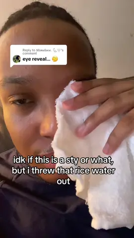 Replying to @𝑺𝒍𝒊𝒎𝒆𝒍𝒐𝒗𝒆. 🐇🤍 I threw that rice water out, I’ll stick to the ordinary #skincare #sty #diyfail 