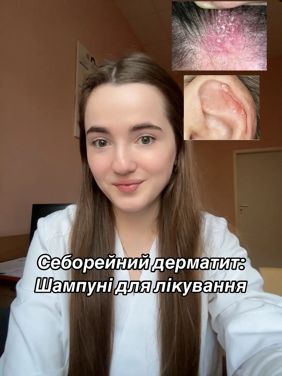 Запис на онлайн консультацію у мене в інстаграм dr.kniazieva #дерматолог  #косметолог #косметологкиїв #дерматологкиїв #косметологукраїна #дерматологукраїна #себорейнийдерматит 