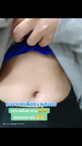 ถ้าตื่นเต้นเจาะเสร็จจะได้นอนดมยาต่อ😂😂😂#เด็กแป้น่าฮัก 