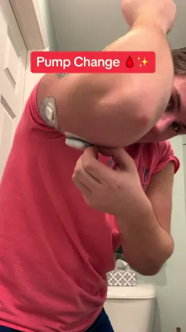 Guy struggles with the adhesive while changing out his insulin pump after three days #BVIRAL @alexxfromtargett