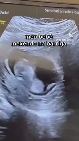 toda vez isso 🤡  #gravida #gravidez #maternidade #viral #fy #pregnant #ultrassonografia #bebemexendonabarriga #fabiolamelo 