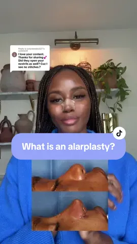 Replying to @judywanjiku527 yes they did open up my nostrils [what’s called an alarplasty] and there were some stitches but luckily no scarring 😊 #blackgirlrhinoplasty #ethnicrhinoplasty #ethnicnosejob #rhinoplasty #nosejob #highmaintenancetobelowmaintenance #blackgirlnosejobrecovery #ethnicnosejobrecovery #nosejobrecovery #rhinoplastyrecovery #rhinoplastyswelling #nosejobswelling 