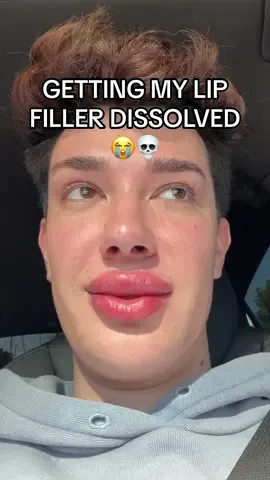 I LITERALLY LOOK LIKE THE MONSTERS INC LIPS GIRL OH MY GODDDDDDDD 😭😭😭