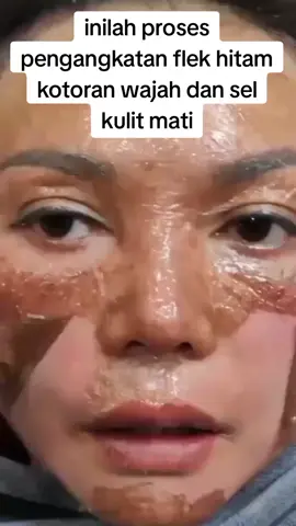 #skincare #flekhitam #malasma 