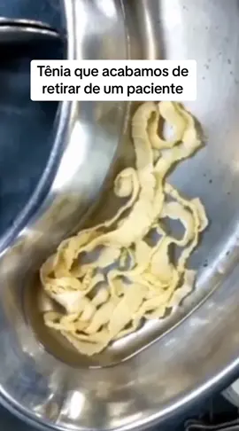 #tenia #atencion #parasite #informacion #asmr #saude #transmission #cuidado #emergency #perigo #vermes Tênia retirada de um paciente 