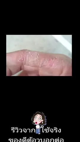 #ครีมทามือ  #ครีมทามือแห้ง #ครีมทามือน้ํามันม้า #ครีมน้ํามันม้า #naiyana959 