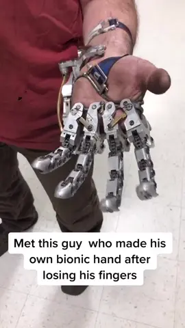 This guy made his own bionic hand!🦾 Follow @engineerplace for more! Via: @uncledswoodshop #robot #robotic #robotics #roboticengineering #mechatronics #robotreels #roboticengineer #cobot #cobots #robotica #robotech #robotarm #robotdesign #robots #robotika