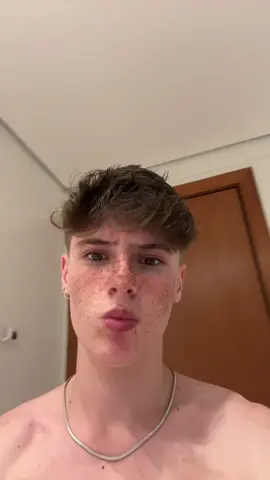 cade o filtro de sarda normal???? #fy 