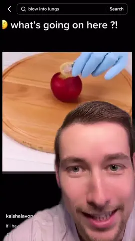 The apple one 😭