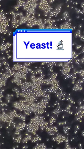 Stitch with @ryan katherine yeast under the microscope 🔬 #microscope #echorebel #foryou #stem #sourdoughstarter #yeast 