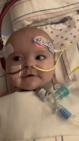 Our baby Aubrey had to go back to the OR this week after her trach was placed due to it being blocked and bleeding. She is still on ECMO life support and predicted to be for months but she’s been taking baby steps in the right direction. Placing the trach allows aubrey to be more mobile and for my sister to be able to hold her everyday. My sister can not thank all her prayer warriors enough, they are working. Please continue to pray 🙏🏻❤️ #ECMO #rsv #PICu  #RSVwarrior #mother #pain #emotional #video #😭 #movement #crying #fyp #viral #fypシ゚viral #foryourpage 